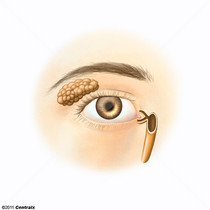 Aparelho lacrimal