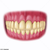 Arcada sseo-Dentria