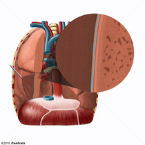 Cavidade Pleural