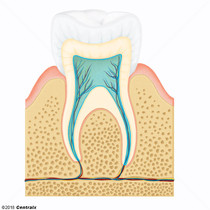Canal radicular