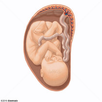 Cordo Umbilical