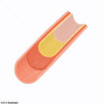 Endotlio vascular