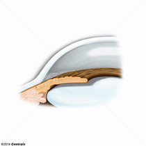 Malha Trabecular