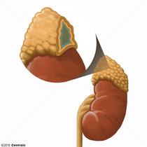 Medula Suprarrenal