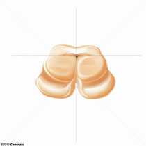 Mesencfalo