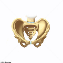 N70 - Salpingite e ooforite - HiDoctor CID-10