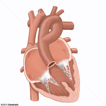 Tronco Arterial