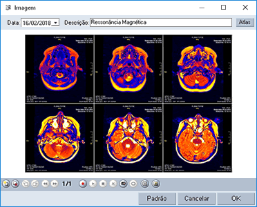 Uso de imagens no prontuário HiDoctor