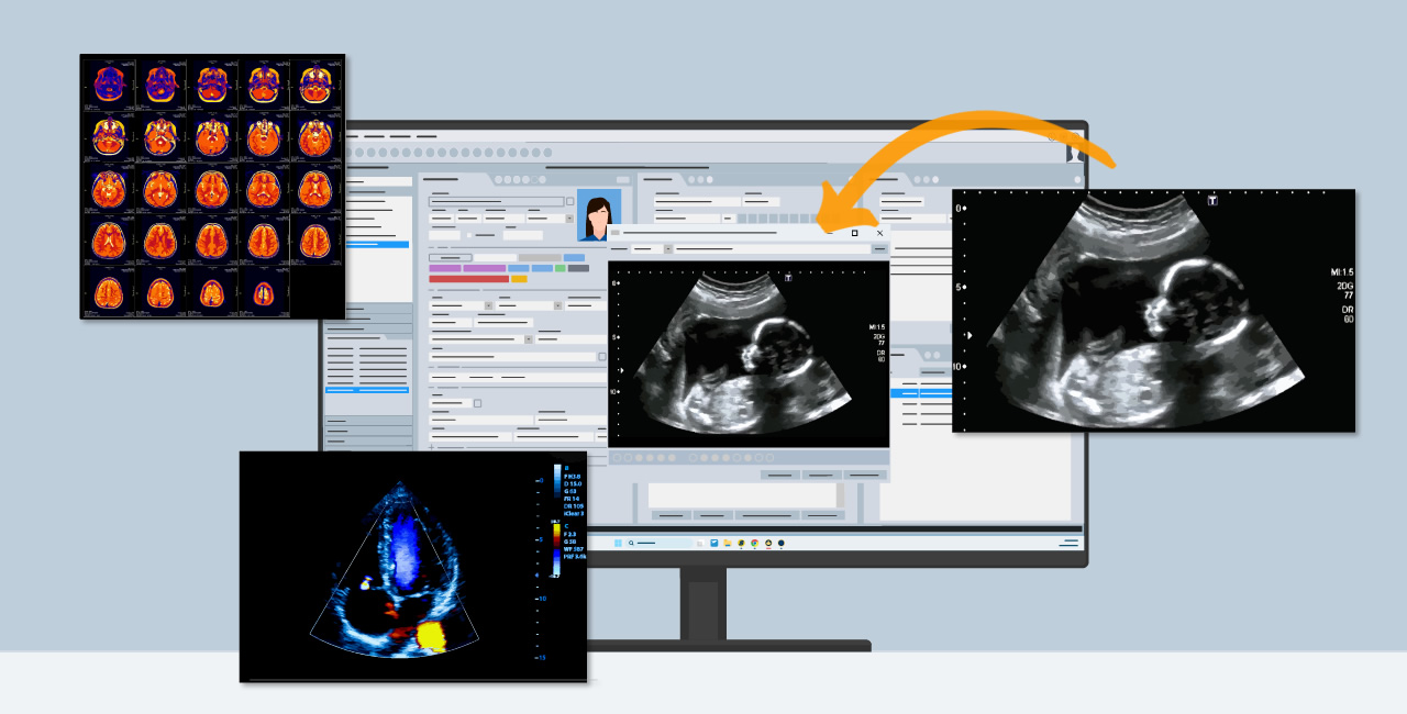 Integrando exames de imagem ao prontuário eletrônico do HiDoctor®