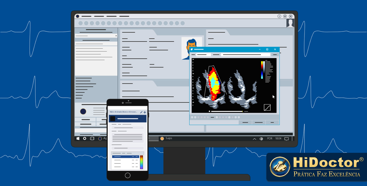 Software para cardiologia: como a tecnologia traz vantagens ao atendimento